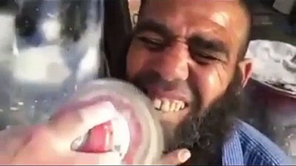 Se faire blanchir les dents chez le mécano... Ahaha