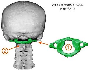 Akо је неком срце стало