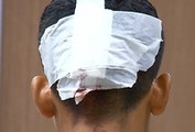 Un joven fue atacado por sus propios compañeros a las afueras de una unidad educativa