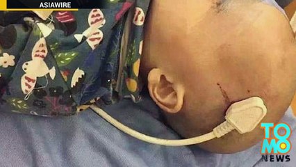 Menino chinês tem sua cabeça perfurada por plugue elétrico.