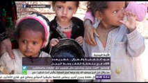 سوء التغذية والهزال في منطقة القفر وسط اليمن خطر يهدد الآلاف