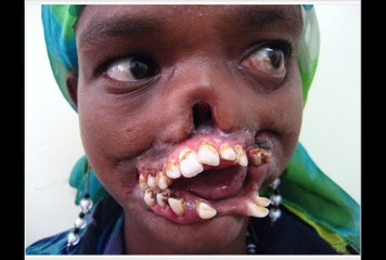 Những căn bệnh nguy hiểm khủng khiếp nhất thế giới