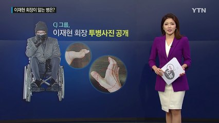 이재현 CJ 회장이 앓는 '샤르코마리투스' 병은? / YTN (Yes! Top News)