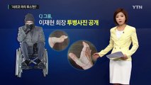 이재현 회장이 앓는 '샤르코 마리 투스'병은? / YTN (Yes! Top News)