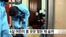 홧김에 4살 조카 살해한 이모...시신 곳곳에 멍 / YTN (Yes! Top News)