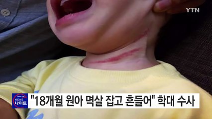 18개월 원아 멱살 잡고 흔들어" 학대 수사 / YTN (Yes! Top News)
