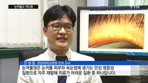 눈꺼풀에도 여드름 생긴다...안구건조증 조심 / YTN (Yes! Top News)