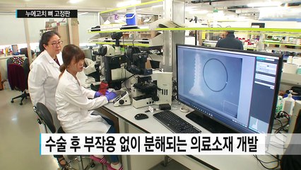누에고치로 만든 뼈 고정판...제거 필요 없어 / YTN (Yes! Top News)
