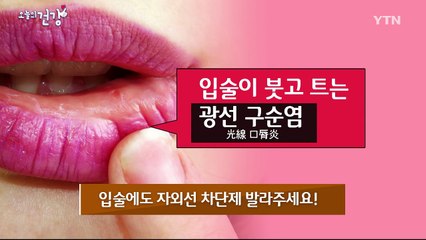 환절기, 입술이 트고 갈라진다? / YTN (Yes! Top News)