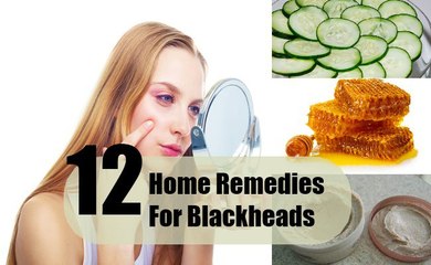 Home Remedies for Blackheads - How to made Home Remedies for Blackheads - Health Care Tips - Health Tips - Health and Fitness Tips - Health Tips For Men - Health Tips for women - Natural Health Tips