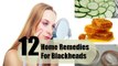Home Remedies for Blackheads - How to made Home Remedies for Blackheads - Health Care Tips - Health Tips - Health and Fitness Tips - Health Tips For Men - Health Tips for women - Natural Health Tips