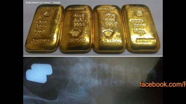 وہ آدمی جو ٹوائلٹ جاتا ہے تو بول وبراز کی بجائے جسم سے سونا نکلتا ہے-erg36fOhg7U