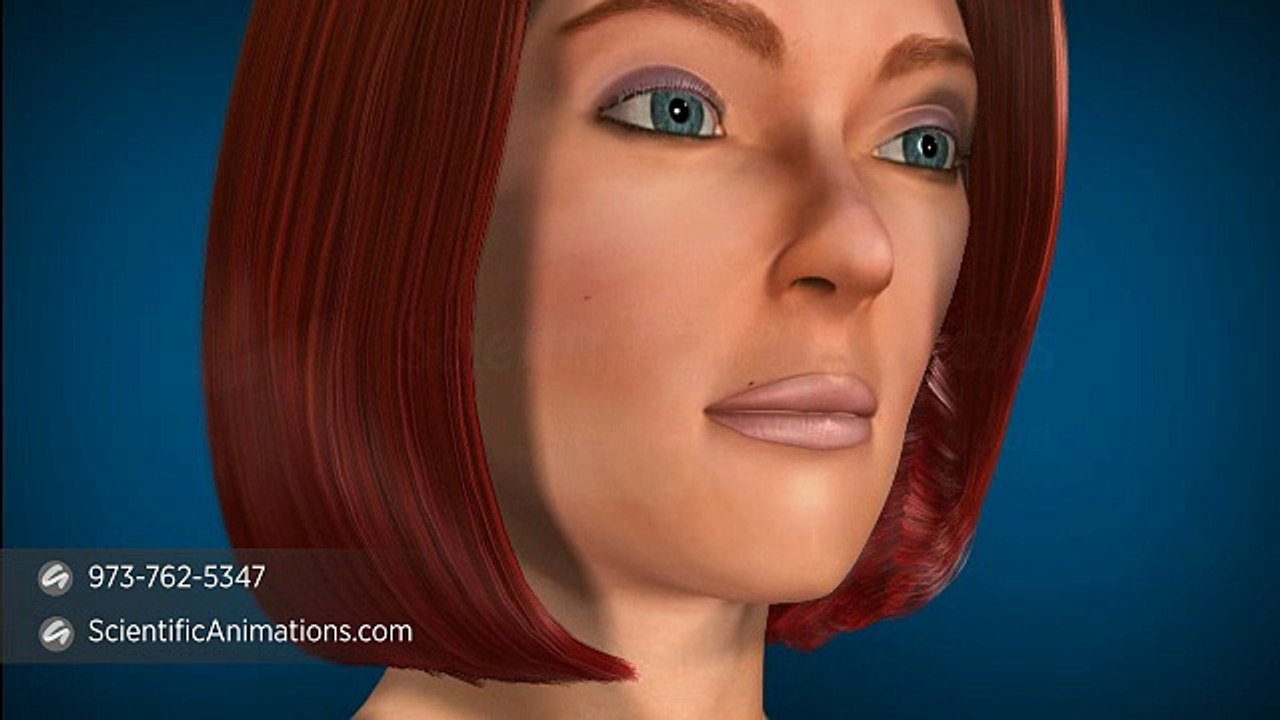 Dental Radiograph or Dental X-rays - 3D Medical Animation