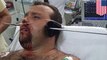 Man speared through head: spearfishing accident goes horribly wrong, impales man’s face