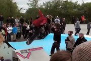 Il reçoit une planche de skate en pleine tête !