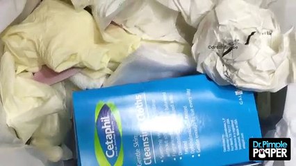 Ja çfarë ka pasur ky njeri në kokë