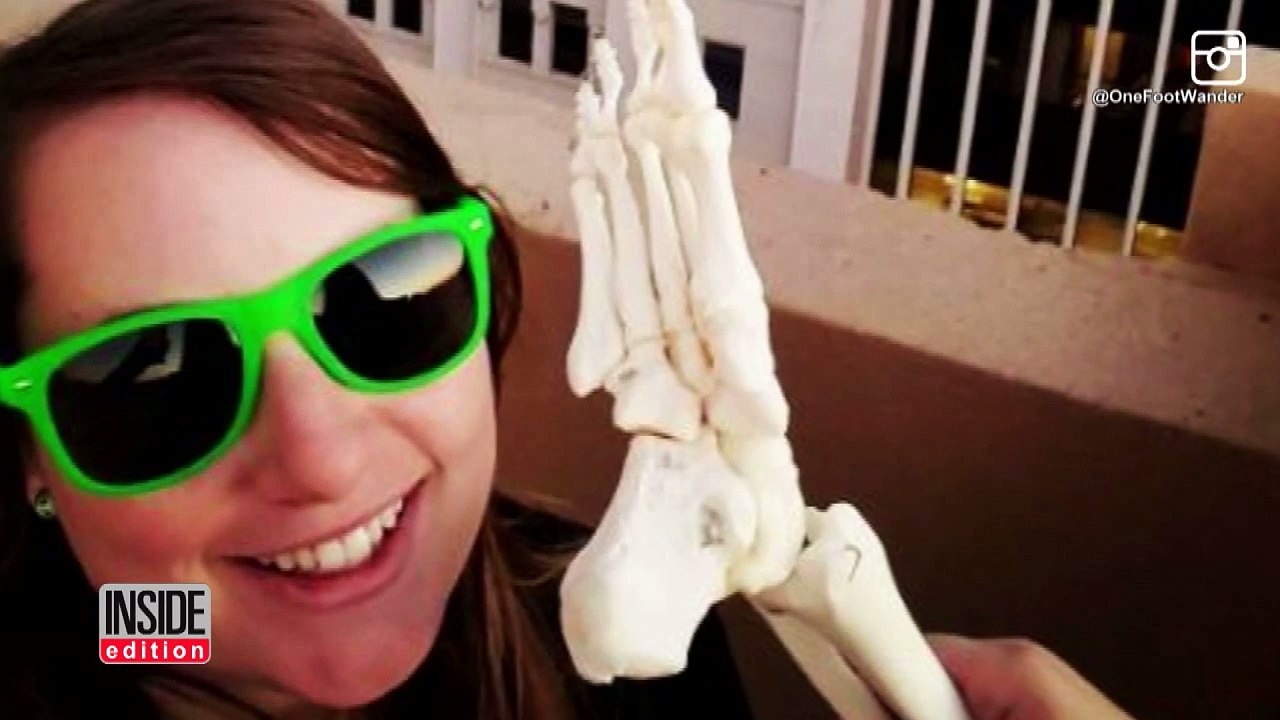 Cancer Survivor Takes Funny Instagram Photos With Her Amputated Foot-KWWT1C4VhoY