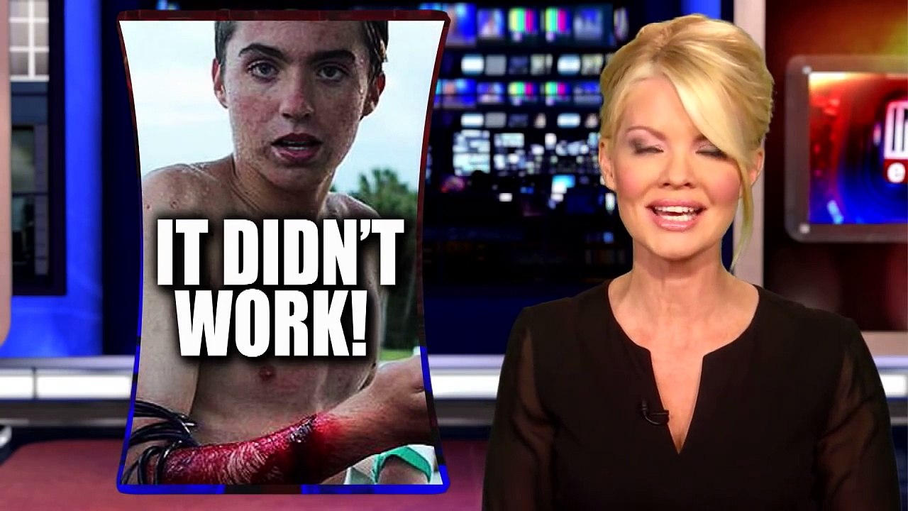 Teen Surfer Survives Shark Attack Despite Wearing Band Meant To Repel Them-NzhHZssTUug