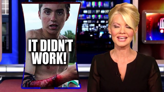 Teen Surfer Survives Shark Attack Despite Wearing Band Meant To Repel Them-NzhHZssTUug