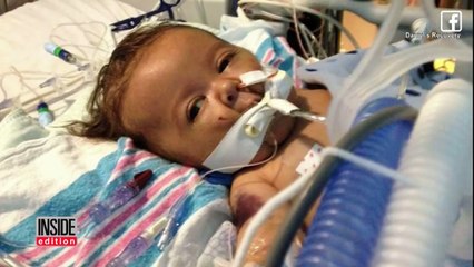 Doctors Find Donor Match In 40 Minutes For 5-Month-Old In Need Of Transplant-G726-bg6P9w