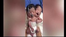 Des parents mettent en ligne la vidéo de leurs jumeaux nés avec deux têtes et un seul corps au Mexique
