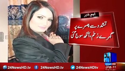 Pakistani Female Singer Tort-ure-d By Husband