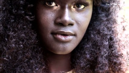 Woman Bullied As Child for Her Dark Completion Becomes Fashion Model-2z_EBFbmMOA