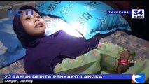 Heboh Manusia Kayu Asal Sragen Jawa Tengah