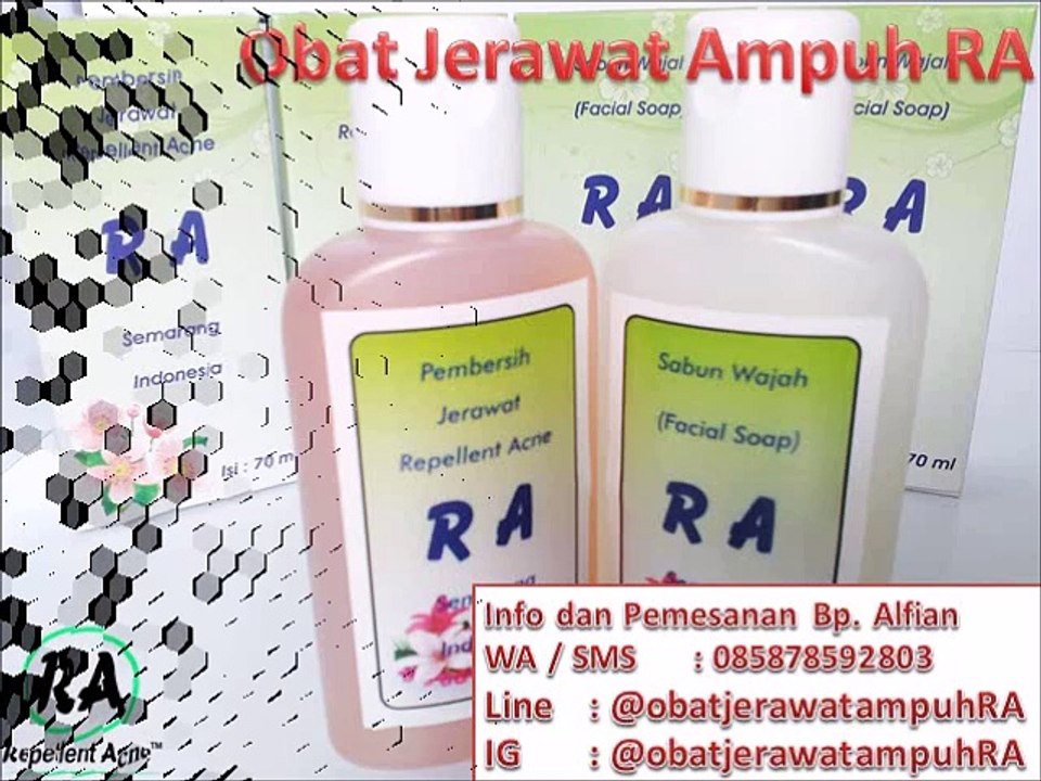 HP 0858 7859 2803 Obat Penyembuh Jerawat Batu Alami Ampuh dan Cepat