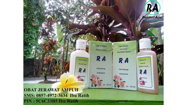 HP 085749723634 Obat Jerawat Paling Ampuh, Cepat, Alami, Di Apotik