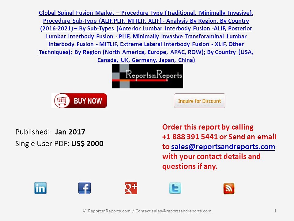 Spinal Fusion Market Research, Industry Trends and Forecasted to Grow 4.82% CAGR by 2021