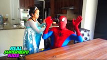 SPIDERMAN vs PREGNANT FROZEN ELSA DOCTOR! Spiderman got HURT Nail in FOOT! Superheroes Real Life