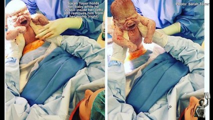 Amazing photos show Queensland mum delivering her own baby by c-section