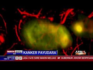 Alat Pendeteksi Kanker Payudara