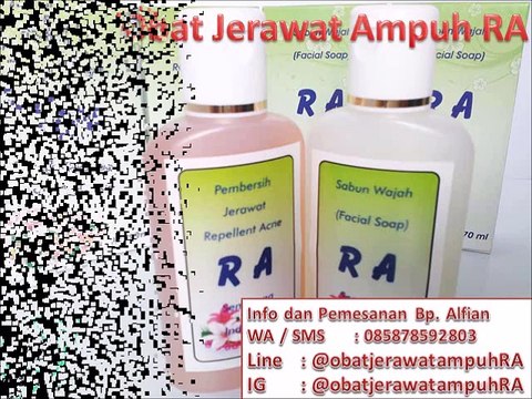 HP 0858 7859 2803 Obat Untuk Jerawat Batu di Apotik