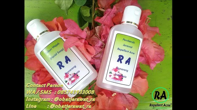 HP 0857 4393 3008 Obat Anti Jerawat Dan Menyembuhkan Jerawat Dan Menghilangkan Bekas Jerawat