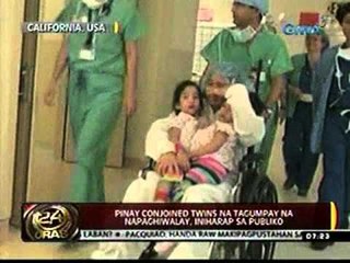 24 Oras (111511) Napaghiwalay na Pinay conjoined twins, iniharap sa publiko