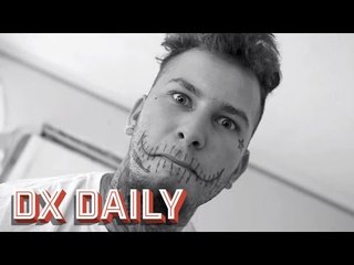 Stitches Challenges The Game To a Boxing Match.