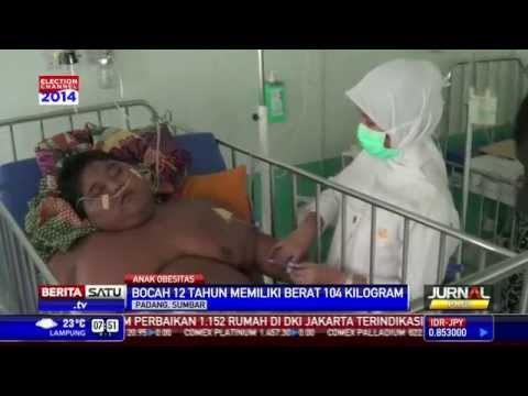 Bocah Obesitas di Padang Terserang Penyakit Jantung dan Pernafasan