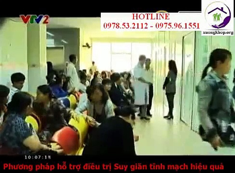 Bệnh giãn tĩnh mạch chân - Cách điều trị giãn tĩnh mạch chân