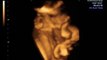 4d baby ultrasound scan at 33 weeks pregnant