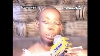 OPEN FLESH CLOSES After PRAYER