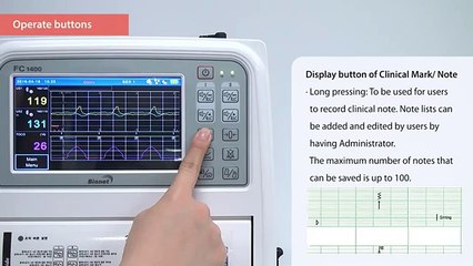 Medical Device Depot Spot Vision Screener Demo