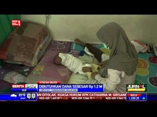 Bayi Penderita Gangguan Fungsi Hati Sudah Dipulangkan