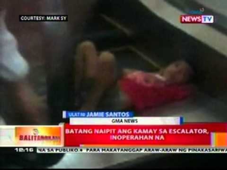 BT: Batang naipit ang kamay sa   escalator, inoperahan na
