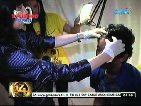 24 Oras: Isang kakaibang sakit sa balat, pinahihirapan ang isang pamilya sa Camarines Norte