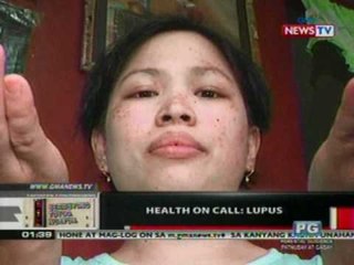OC:  Health On Call: Lupus