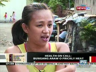 OC: Health On Call: Bungang araw o prickly heat