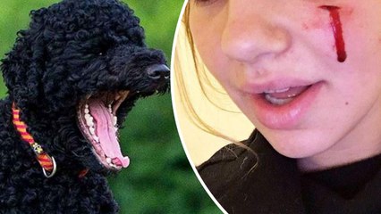 President Obama's Dog Bites White House Visitor In The Face