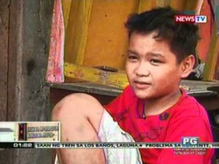 OC: Paano maiiwasan at malulunasan ang pigsa? (042612)